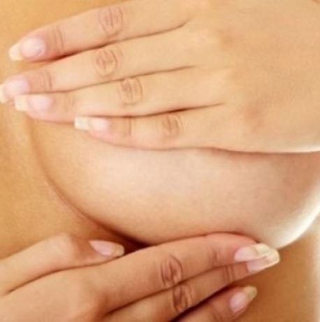 Έχεις ραγάδες στο στήθος μετά από εγκυμοσύνη; Η λύση είναι…