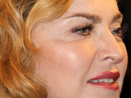 Το πρόσωπο της Madonna... πάγωσε!