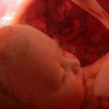 Έτσι περνούν την ώρα τους τα μωρά μέσα στην κοιλιά μας!