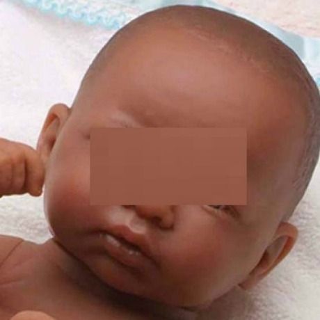 Λευκή γυναίκα που γέννησε μαύρο μωρό μηνύει τράπεζα σπέρματος