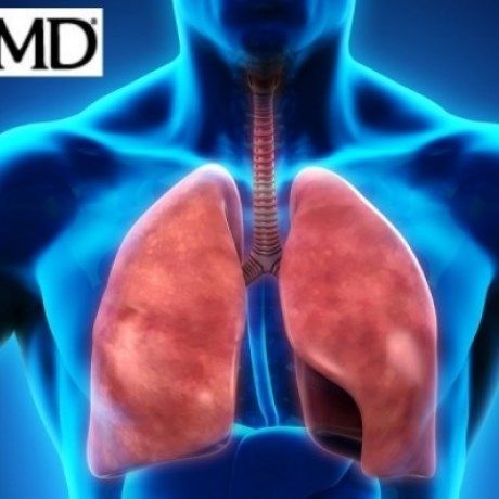 Βρογχίτιδα: Αίτια, συμπτώματα και τρόποι αντιμετώπισης