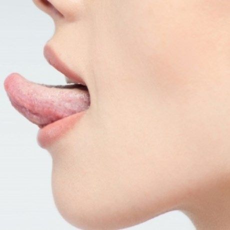 Γλωσσίτιδα: Αίτια κι αντιμετώπιση