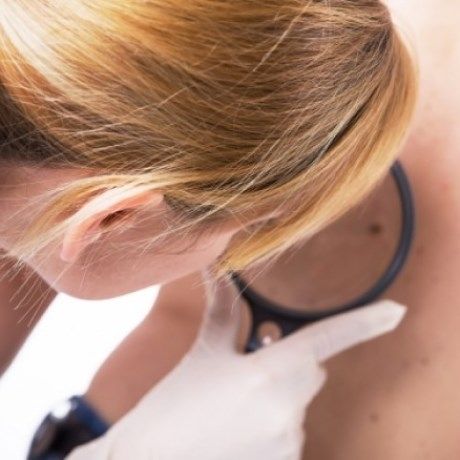 Κόκκινες ελιές: Είναι επικίνδυνες ή όχι;