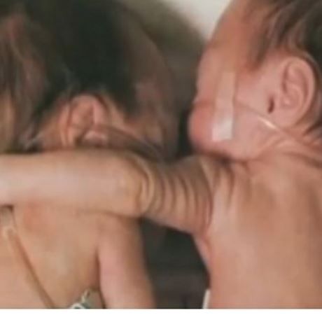 Αγκάλιασε τη δίδυμη αδελφούλα της κι η συνέχεια είναι σοκαριστική