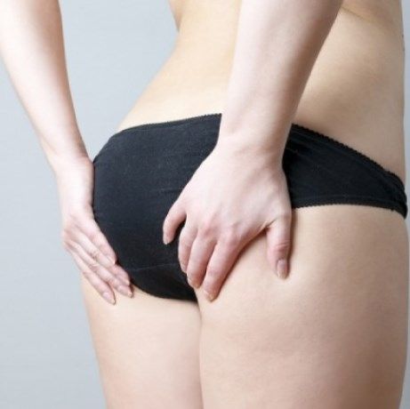 Κυτταρίτιδα: 3 στοχευμένες ασκήσεις για να την εξαφανίσετε