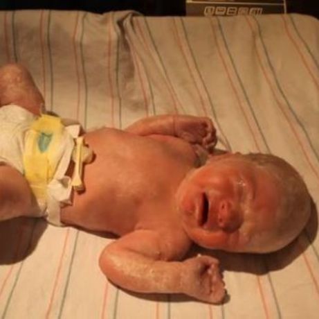 Βίντεο στο Youtube: Δείτε πώς γίνεται το τεστ APGAR στα νεογέννητα