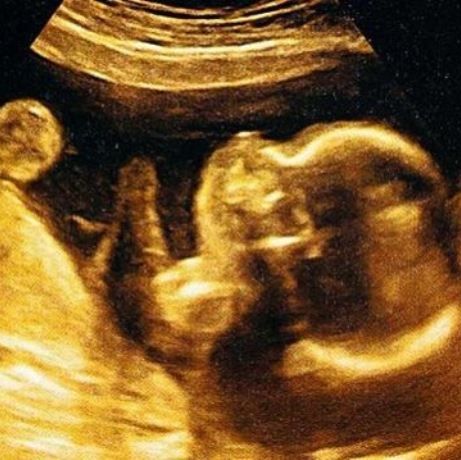 Επτά πράγματα που κάνουν τα μωρά μέσα στη μήτρα και θα σας εκπλήξουν!