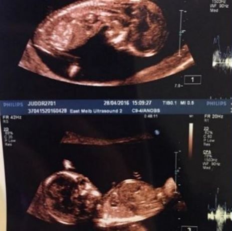 Διάσημη παρουσιάστρια είναι έγκυος και περιμένει δίδυμα!