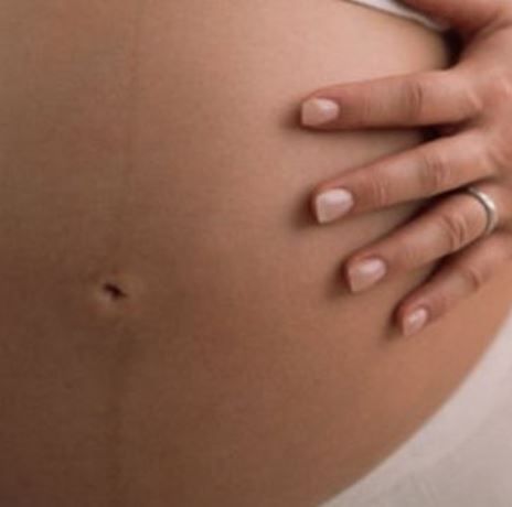 Linea Negra: Όλα όσα πρέπει να γνωρίζετε για την σκούρα γραμμή στην κοιλιά της εγκύου