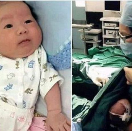 Νοσοκόμα θηλάζει μωρό που δεν σταματούσε το κλάμα πριν το χειρουργείο (εικόνα)