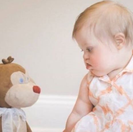 Παγκόσμια Ημέρα για το Σύνδρομο Down- Δείτε το μοναδικό βίντεο με την ηθοποιό Olivia Wilde