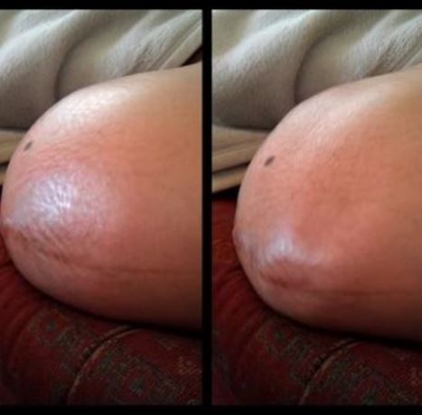 Δίδυμα «μάχονται» στην κοιλιά της μαμάς τους! Το βίντεο που κάνει θραύση