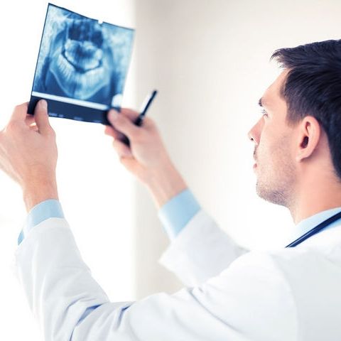 Καρκίνος στόματος: Ανησυχία για τα πολλά κρούσματα νέας ηλικίας