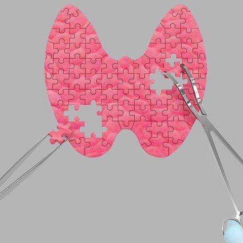 Πρόβλημα με το θυρεοειδή; Κάντε το τεστ των 8 ερωτήσεων