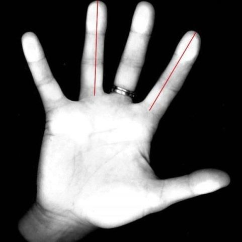 Τα δάχτυλα του χεριού αποκαλύπτουν πόσο επιρρεπείς είστε σε άγχος και κατάθλιψη