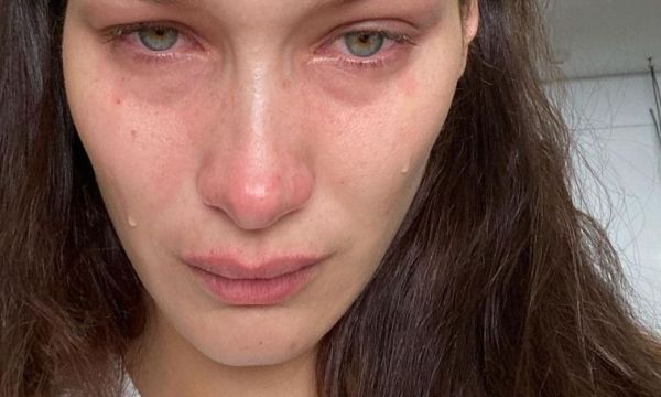 Η Bella Hadid αποκάλυψε ότι κλαίει κάθε μέρα και κάθε νύχτα τα τελευταία χρόνια
