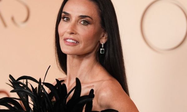 Τα ballet slippers lips είναι η μεγάλη τάση των Oscars 2026 και δε ξέρουμε πως νιώθουμε για αυτό!