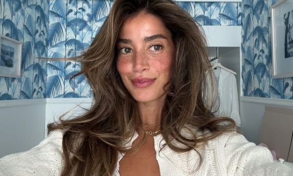 Πώς να επαναφέρεις το hairline σου και την πύκνωση των μαλλιών σου;
