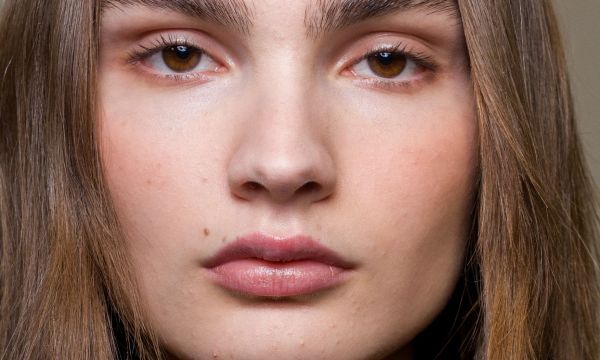 Ferritin face: Τι σημαίνει ο νέος beauty όρος που απασχολεί σχεδόν το 40% των γυναικών