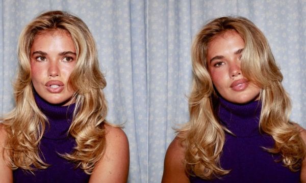 TikTok skincare: Νέα μελέτη συνδέει τα beauty trends με δερματίτιδα, ακμή και ερεθισμούς