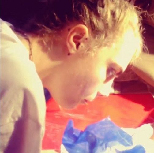 Cara Delevingne: δερματικά προβλήματα και νέα τατουάζ