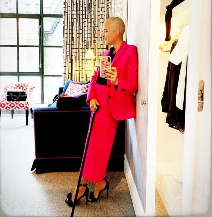 Αλλά και χωρίς τα μαλλιά της αμέσως μετά τη θεραπεία της. 