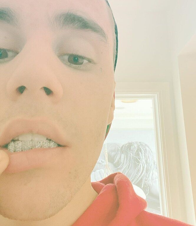 Ιδού τα νέα δόντια του Justin. Ο τραγουδιστής πρόσθεσε στα κάτω δόντια διαμαντάκια στο χρώμα της λεβάντας, τα οποία κόστισαν 25.000 δολάρια. Απίστευτο, κι όμως αληθινό!