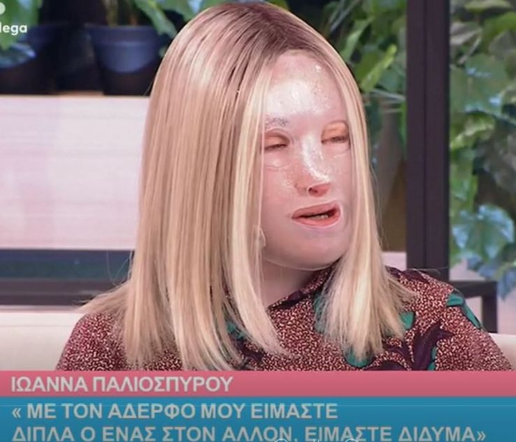 Η Ιωάννα Παλιοσπύρου στο Χαμογέλα Και Πάλι: Τα ρούχα από την επίθεση και η φωτογραφία χωρίς μάσκα