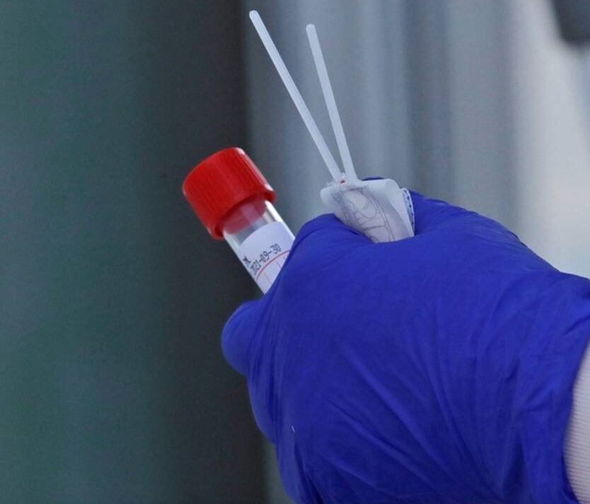 Κορονοϊός: «Βόμβα» από επιστήμονες για την πραγματική εξάπλωση του ιού