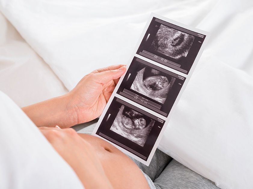 «Θέλω παιδί αλλά έχω αυτοάνοσο»: Τι σημαίνει αυτό στην πράξη και τι μπορείς να κάνεις