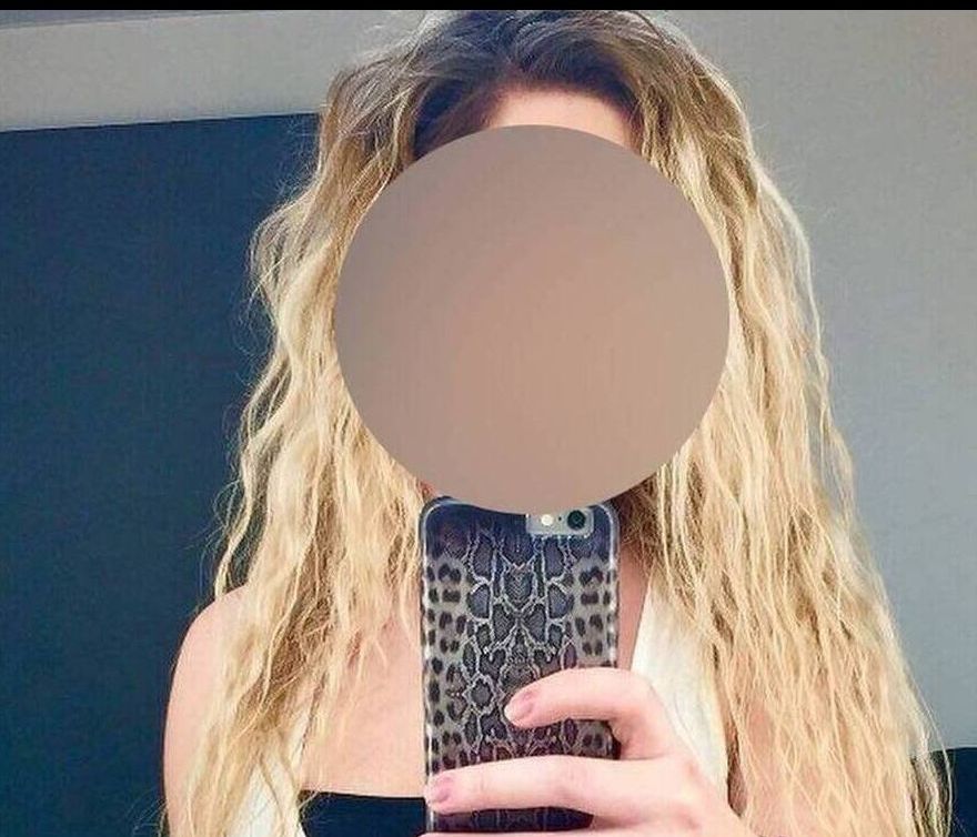 Επίθεση με βιτριόλι: Έκανε το λάθος η «μαυροντυμένη» - Ραγδαίες εξελίξεις