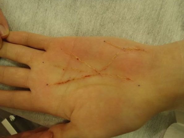 palm-reading-surgery-2