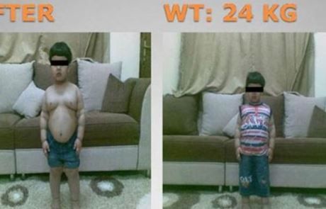 o-OBESE-BOY-AFTER-570