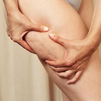 fight-back-against-cellulite-L-KfSLNF