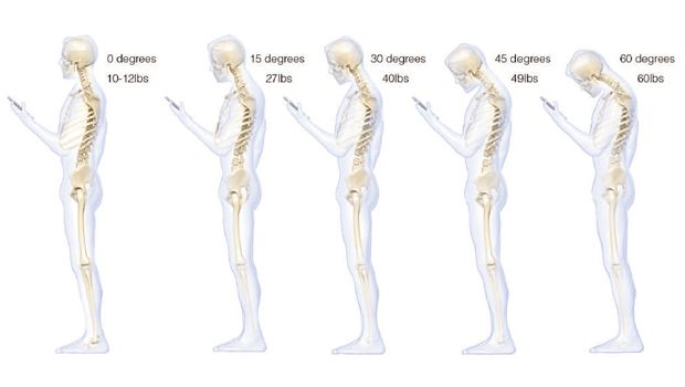 bad-posture-620w ea648