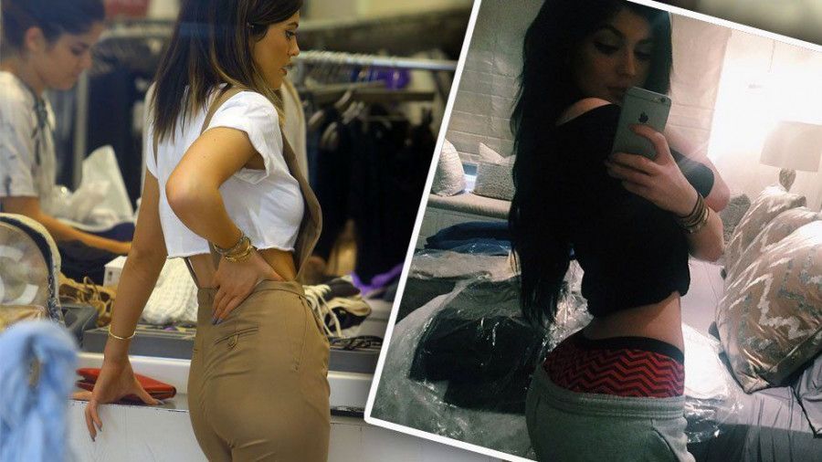 kylie-jenner-plastic-surgery-rumors1 ee783
