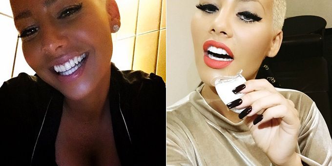 amber-rose-teeth-copy 9c4d7