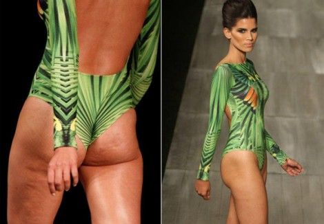 Raica-Celulite-470x326 e6f21