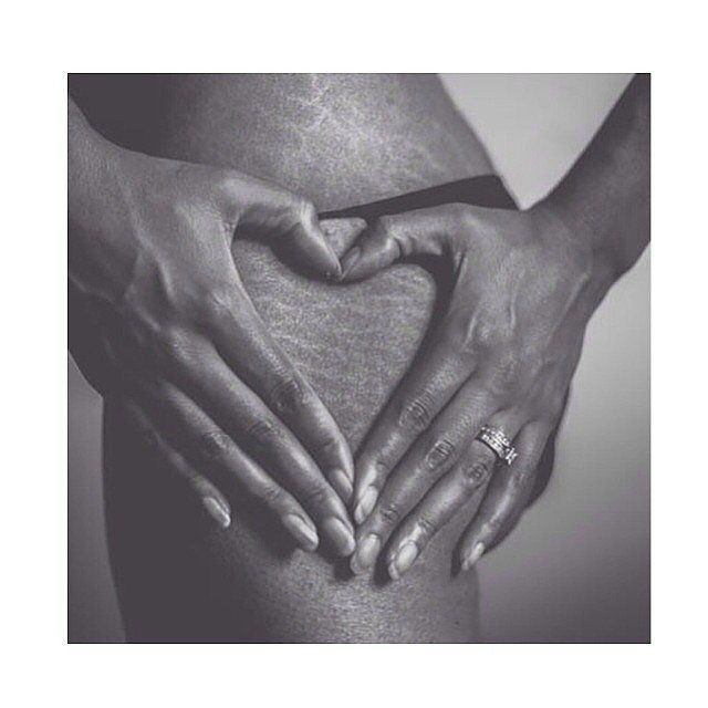 Photos-Stretch-Marks-Love-Your-Lines 7 b7fe8
