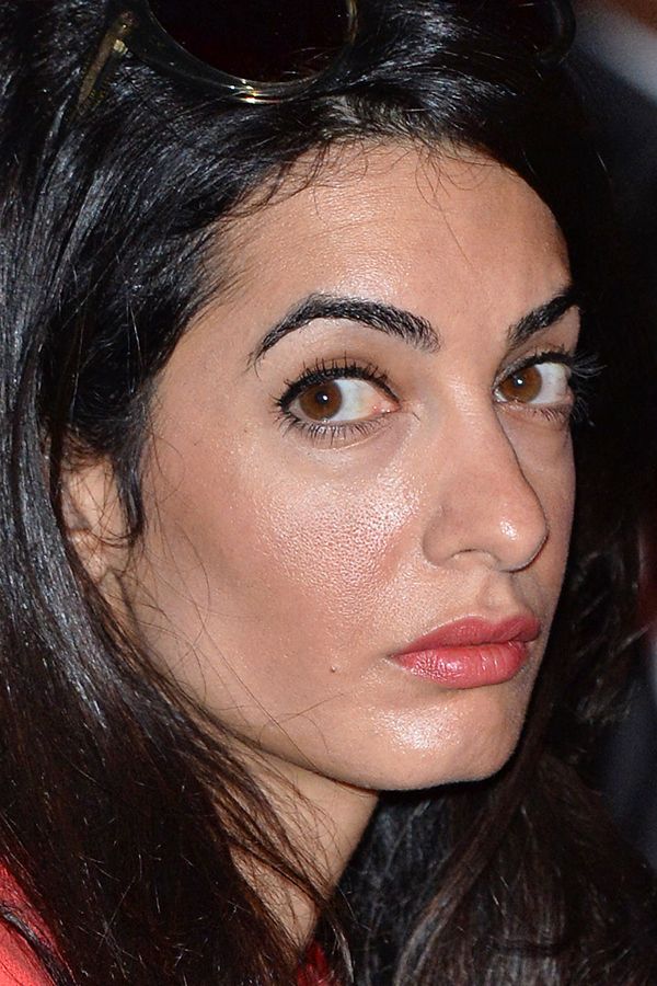 amal-clooney-plastic-surgery-4 e77ec