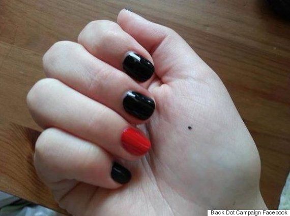 o-BLACK-DOT-CAMPAIGN-570 0f2ca