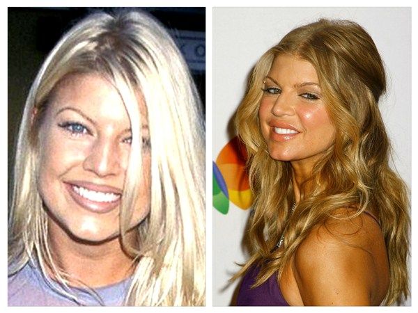 Fergie 3f3d0