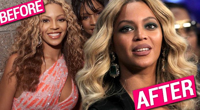 beyonce plastic surgery pp 30c9b