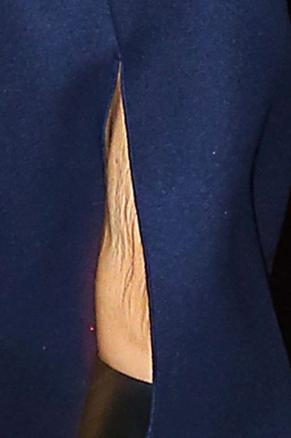 victoria beckham david divorce rumors skinny knee skin sag 04 7e348