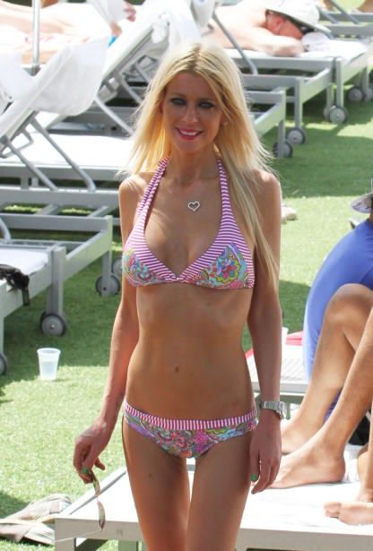 celebrity liposuction plastic surgery 03 fcfe5