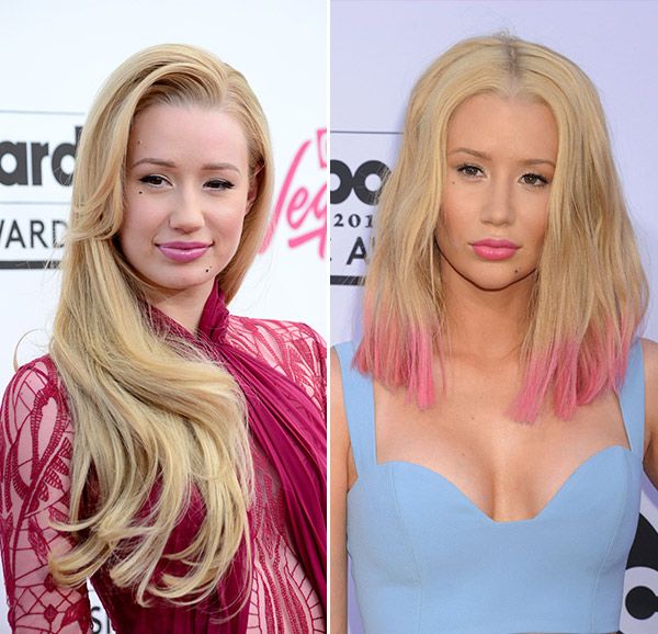 iggy azalea plastic surgery c19aa
