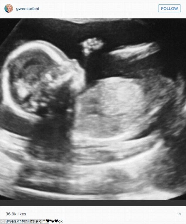 32BE6EF800000578 3519286 image a 39 1459524632520 70198