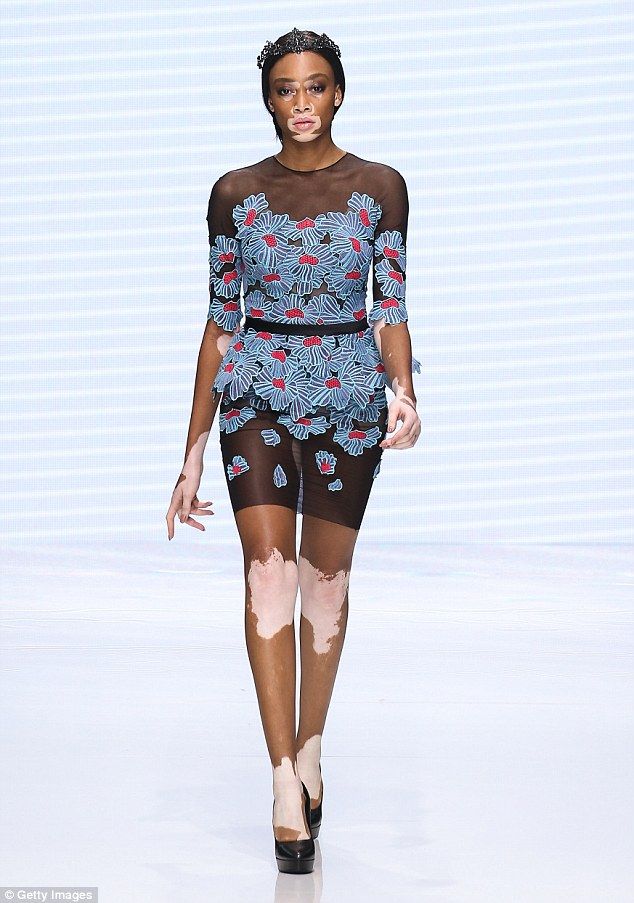 35EC7B5500000578 3672930 image m 180 1467594349259 448b2