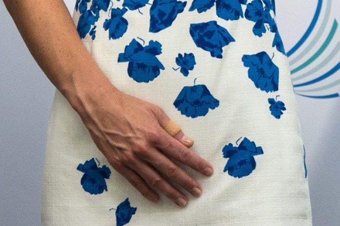 kate middleton bulimia rumors 05