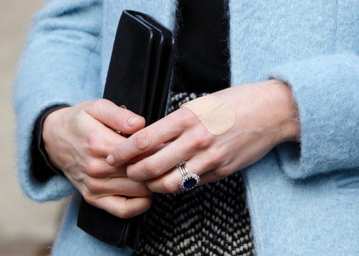 kate middleton bulimia rumors 08